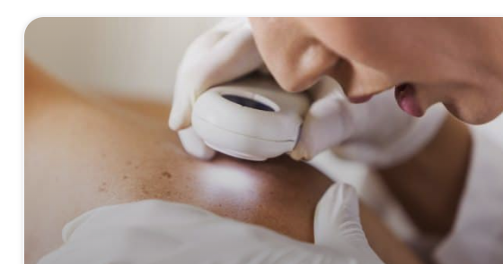Dermatology